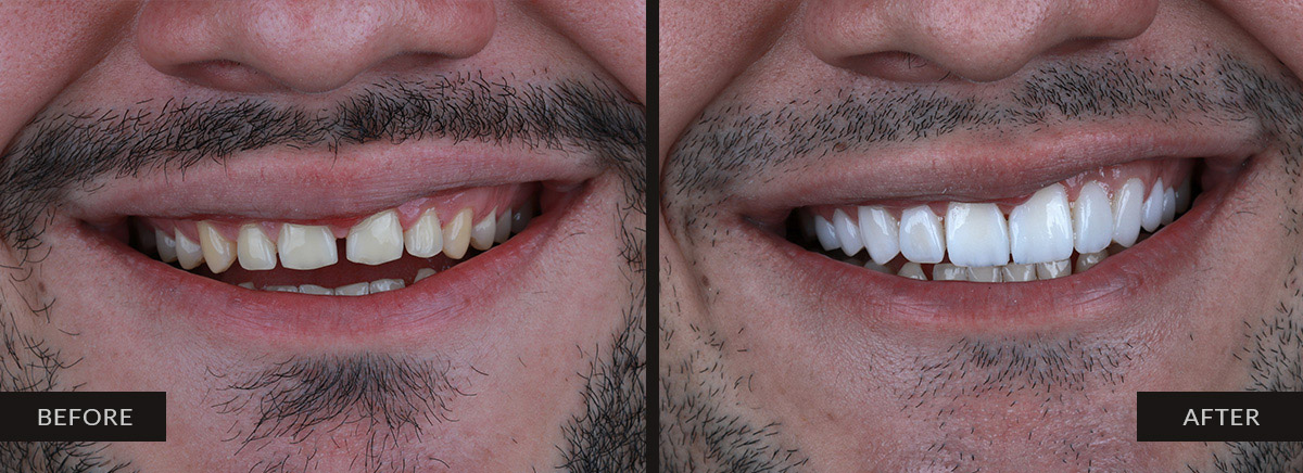 guatemala dental before after 10