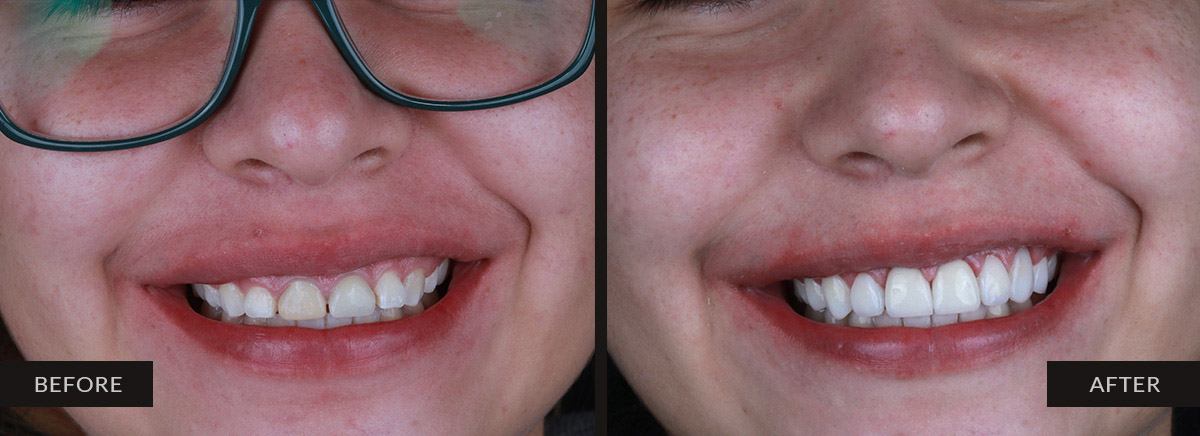 guatemala dental before after 11