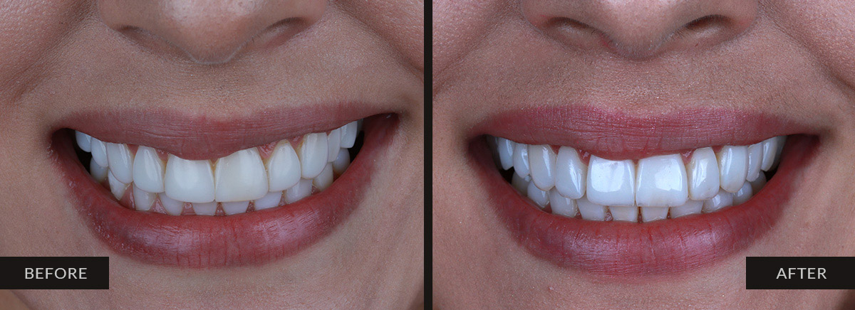 guatemala dental before after 12