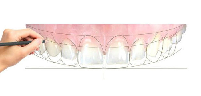 A handcrafted same day smile is now possible