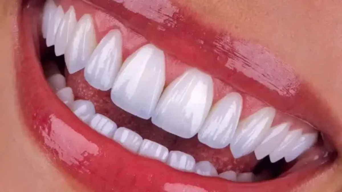 You will believe we are better than dentists in the US